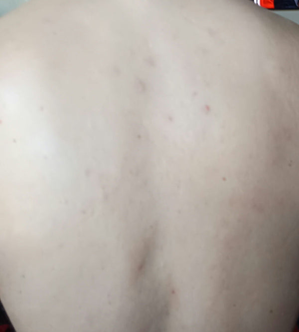 After image for recv7mJRPgABFwrf7