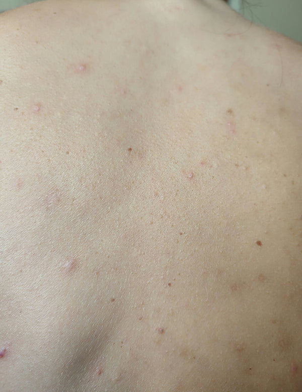 Before image for recv7mJRPgABFwrf7