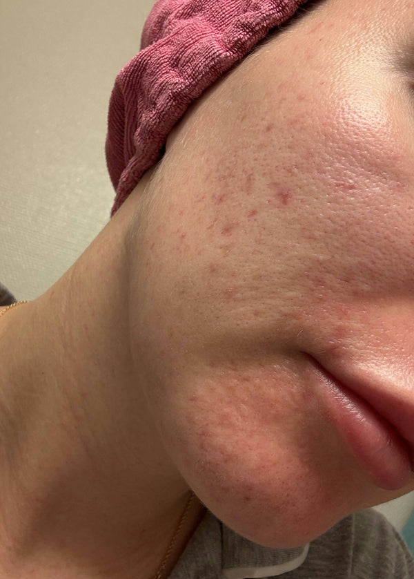 After image for recvJWE5enjOYdJhq