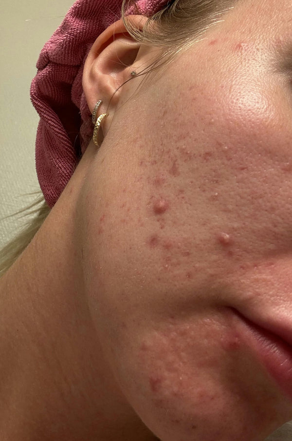 Before image for recvJWE5enjOYdJhq