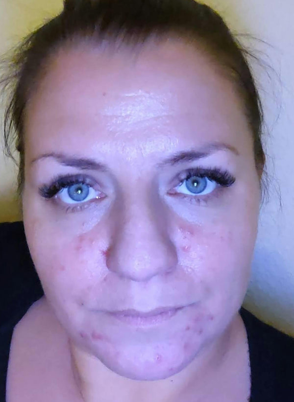 Before image for recxFUvhTm4Yfa4Fm