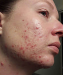 Before image for recys7PO2HZxQJVDN