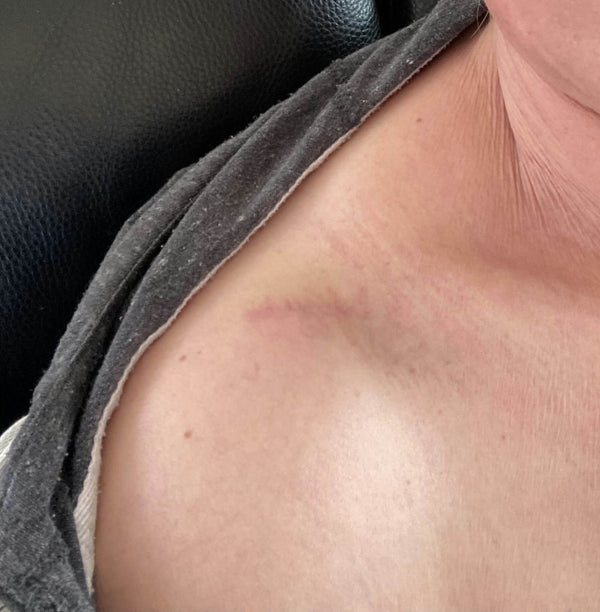 After image for reczF51OLd2JD4TmS