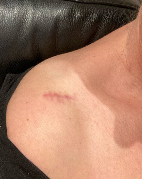 Before image for reczF51OLd2JD4TmS