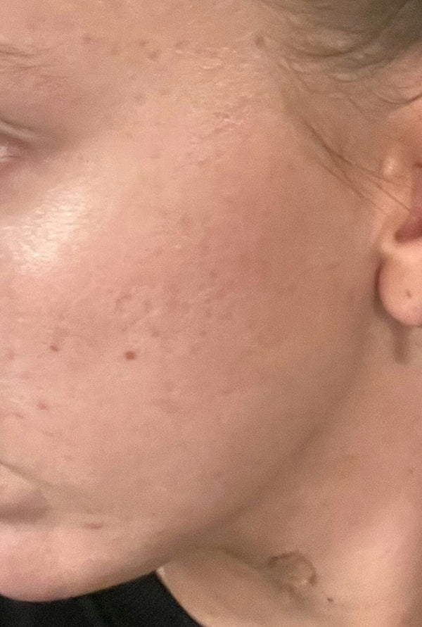 After image for reczVz0Fg5Pf7Wt4o