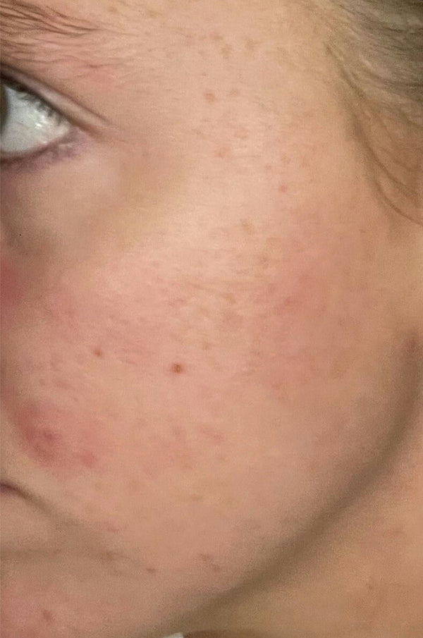 Before image for reczVz0Fg5Pf7Wt4o